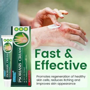 Cvreoz® Knotaway Psoriasis Cream 20 Cvreoz® Knotaway Psoriasis Cream