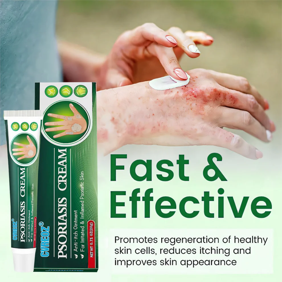 Cvreoz® Knotaway Psoriasis Cream 9 Cvreoz® Knotaway Psoriasis Cream