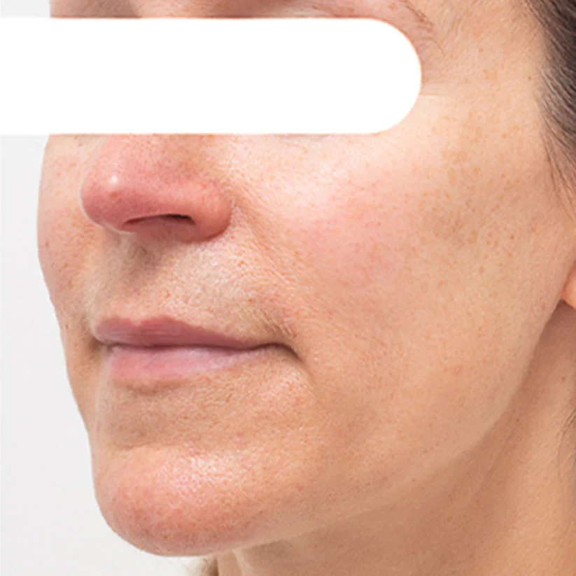 AEXZR® Herbal Stain Peel-Off Face Mask 9 AEXZR® Herbal Stain Peel-Off Face Mask