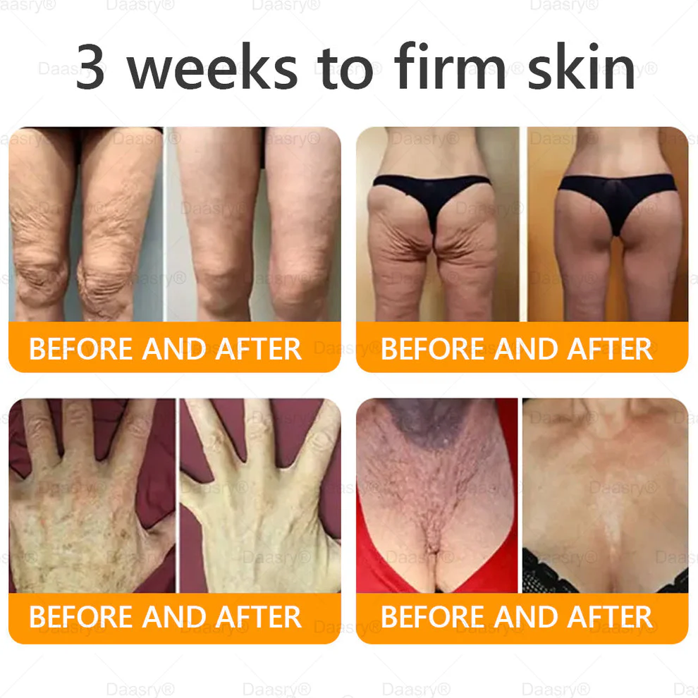 Daasry® Bee Venom Treatment Cream 7 Daasry® Bee Venom Treatment Cream