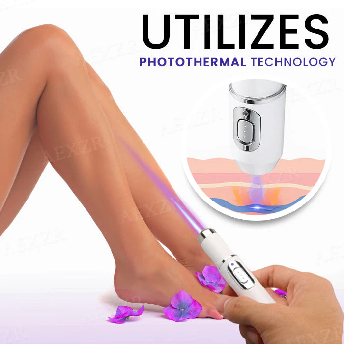 Bikenda® Varicose Vein Photothermal Laser Treatment 5 Bikenda® Varicose Vein Photothermal Laser Treatment