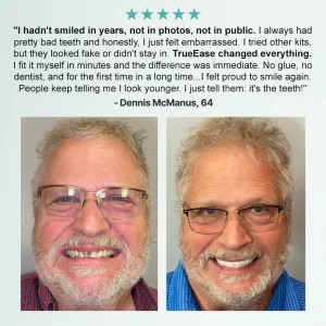 NESLEMY™ Advanced Customized Full Denture Set 15 NESLEMY™ Advanced Customized Full Denture Set