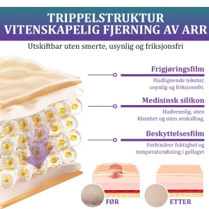 Flysmus® ReGen Hyaluronic Acid Nano-Heal Microneedle Tape 11 Flysmus® ReGen Hyaluronic Acid Nano-Heal Microneedle Tape