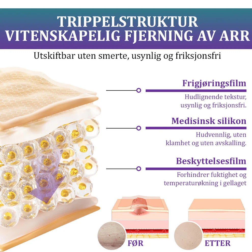 Flysmus® ReGen Hyaluronic Acid Nano-Heal Microneedle Tape 3 Flysmus® ReGen Hyaluronic Acid Nano-Heal Microneedle Tape