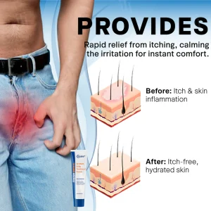 Croaie® Scrotum Itchy Treatment Cream 11 Croaie® Scrotum Itchy Treatment Cream