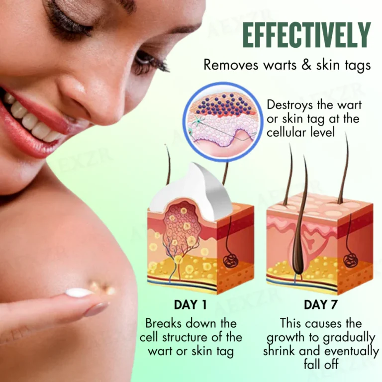 AEXZR® WartsOff Instant Blemish Removal Cream 5 AEXZR® WartsOff Instant Blemish Removal Cream