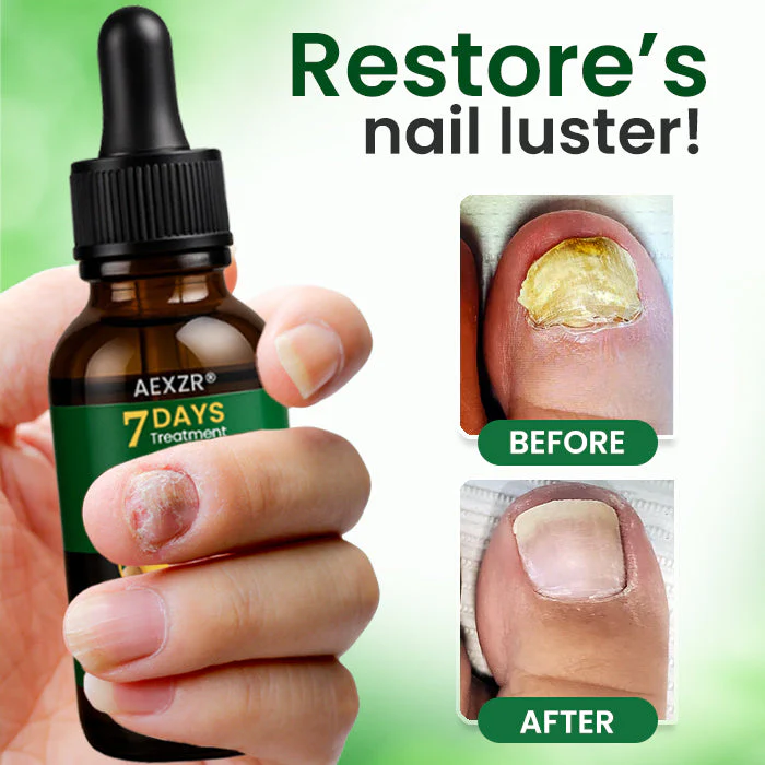 AEXZR® Fungal Nail Treatment 3 AEXZR® Fungal Nail Treatment