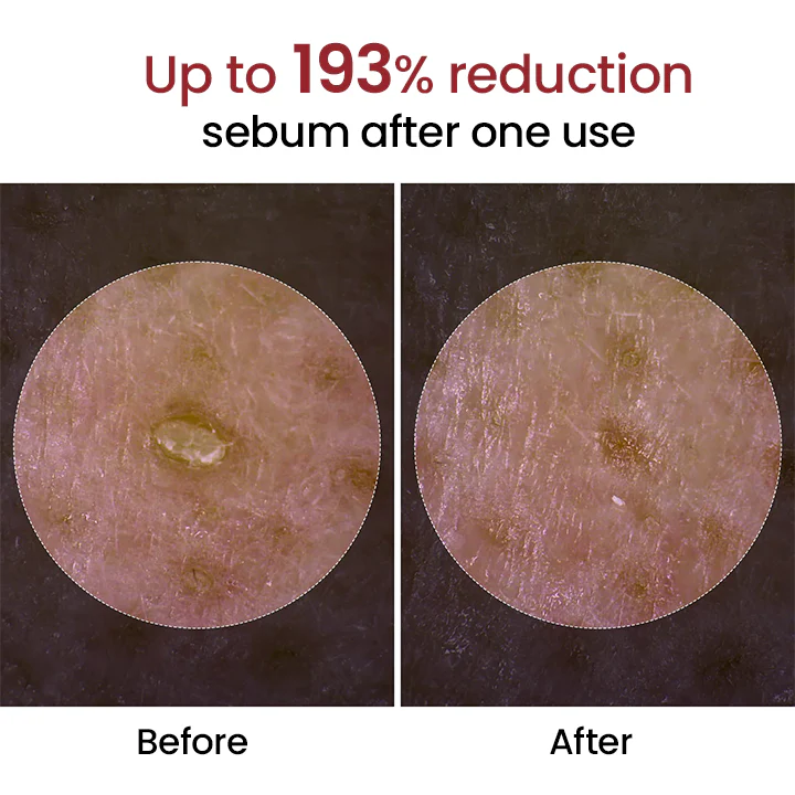 Biancat® Peel Shot Glow Black Rice Ampoule 7 Biancat® Peel Shot Glow Black Rice Ampoule