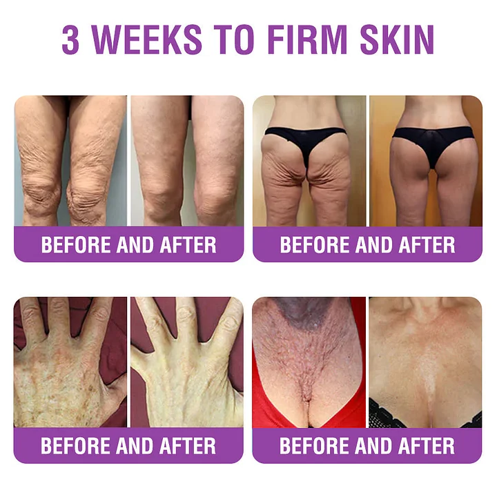 YUNPSO™ Queen Nectar Peptide + Bakuchiol Skin Restoration Cream 5 YUNPSO™ Queen Nectar Peptide + Bakuchiol Skin Restoration Cream