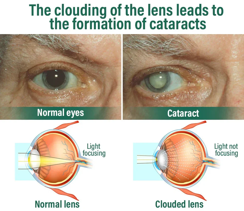 NESLEMY™ Nano Vision Repair Eye Serum 5 NESLEMY™ Nano Vision Repair Eye Serum