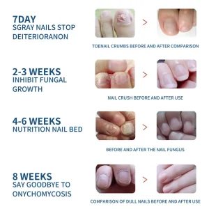 Health Care Patches – Repair and Strengthen Weak Nails 14 Health Care Patches – Repair and Strengthen Weak Nails