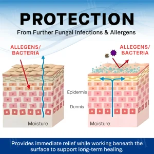 Croaie® Scrotum Itchy Treatment Cream 10 Croaie® Scrotum Itchy Treatment Cream