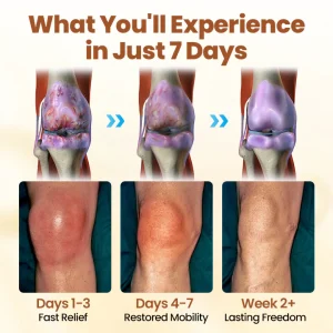 Biancat® Premium Curcumin Pain Relief Gel 16 Biancat® Premium Curcumin Pain Relief Gel