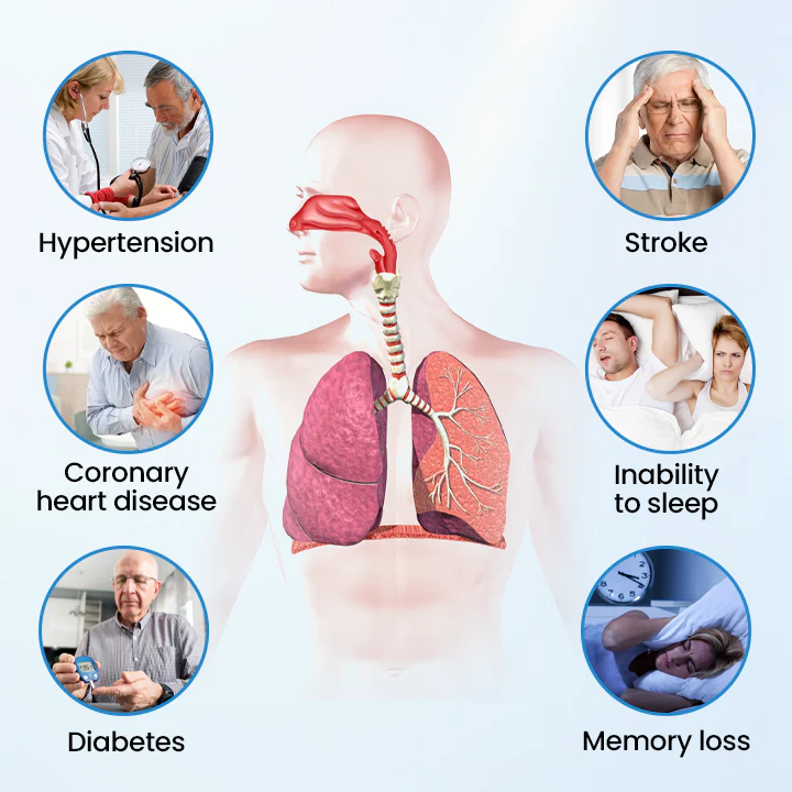 Timilk® SnoreLess Nasal Breather 6 Timilk® SnoreLess Nasal Breather