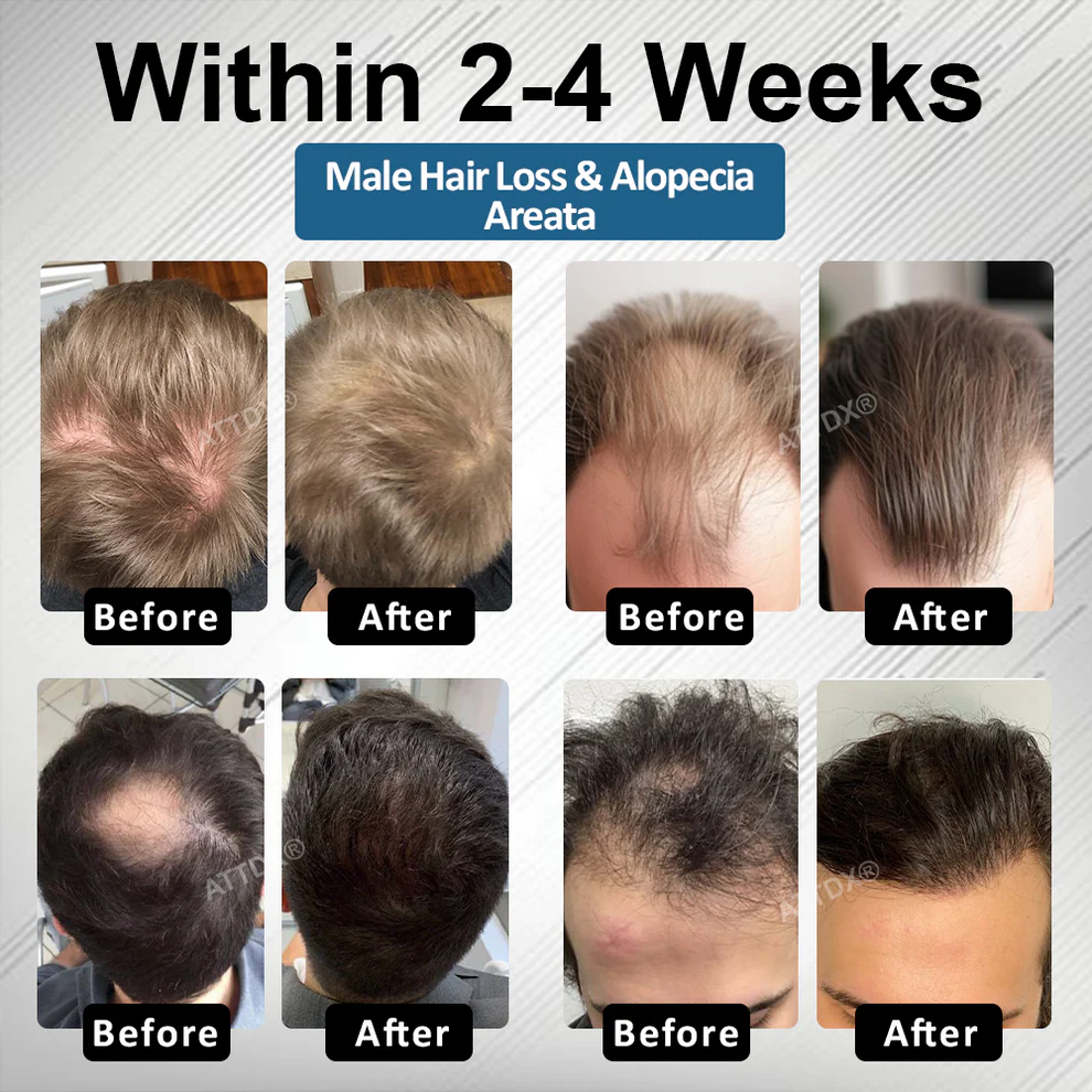 ATTDX® Hair Reawaken PP405 Roll-On Serum 2 ATTDX® Hair Reawaken PP405 Roll-On Serum