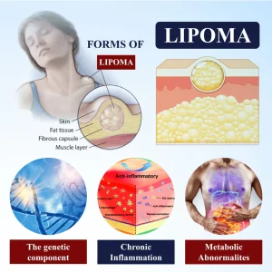 Cvreoz® LipoEase Herbal Matrix-4 Cream 9 Cvreoz® LipoEase Herbal Matrix-4 Cream