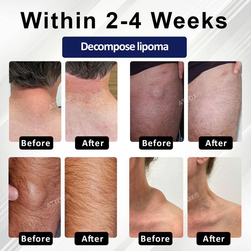 Cvreoz® LipoEase Herbal Matrix-4 Cream 4 Cvreoz® LipoEase Herbal Matrix-4 Cream