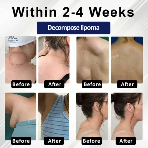 Cvreoz® LipoEase Herbal Matrix-4 Cream 7 Cvreoz® LipoEase Herbal Matrix-4 Cream