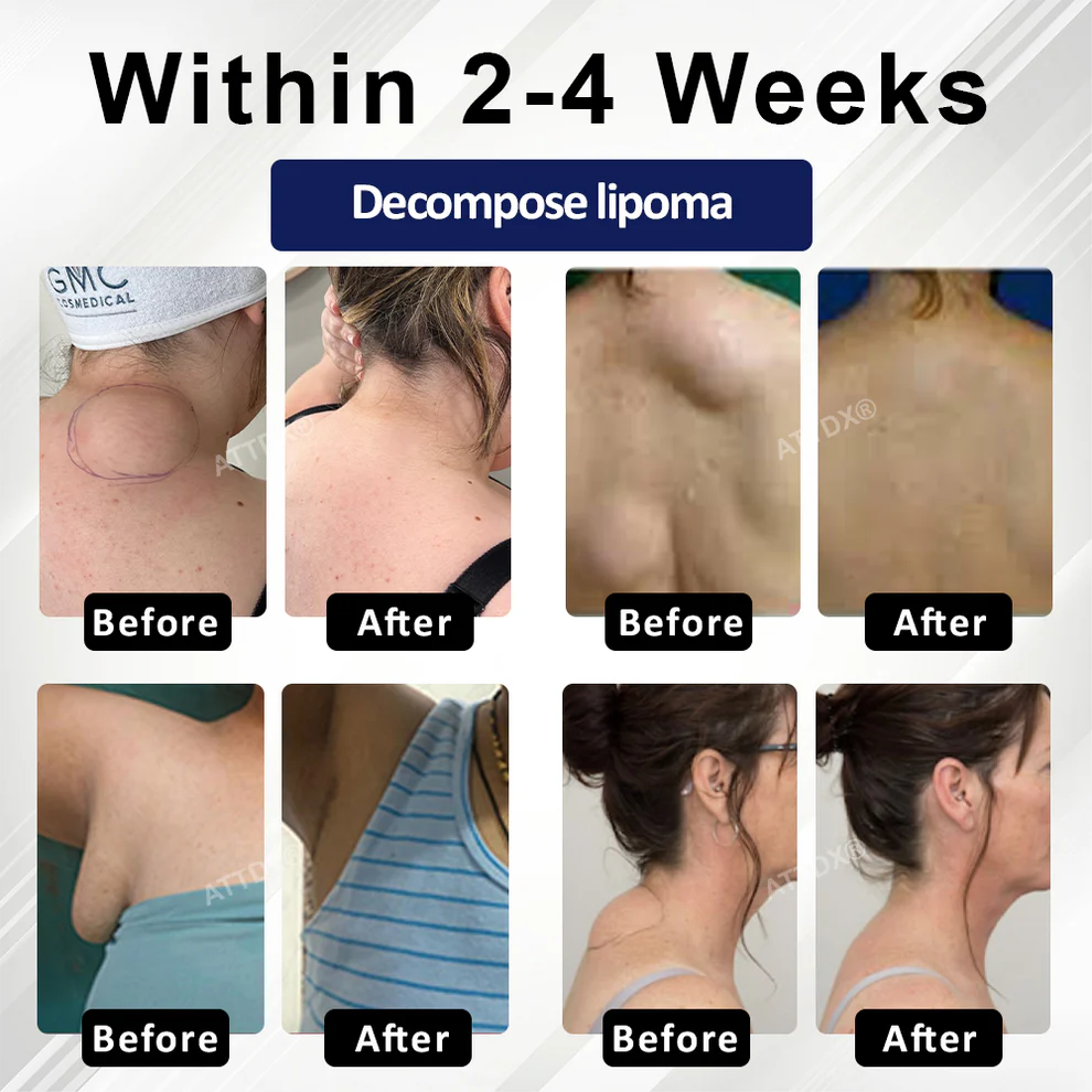 Cvreoz® LipoEase Herbal Matrix-4 Cream 3 Cvreoz® LipoEase Herbal Matrix-4 Cream