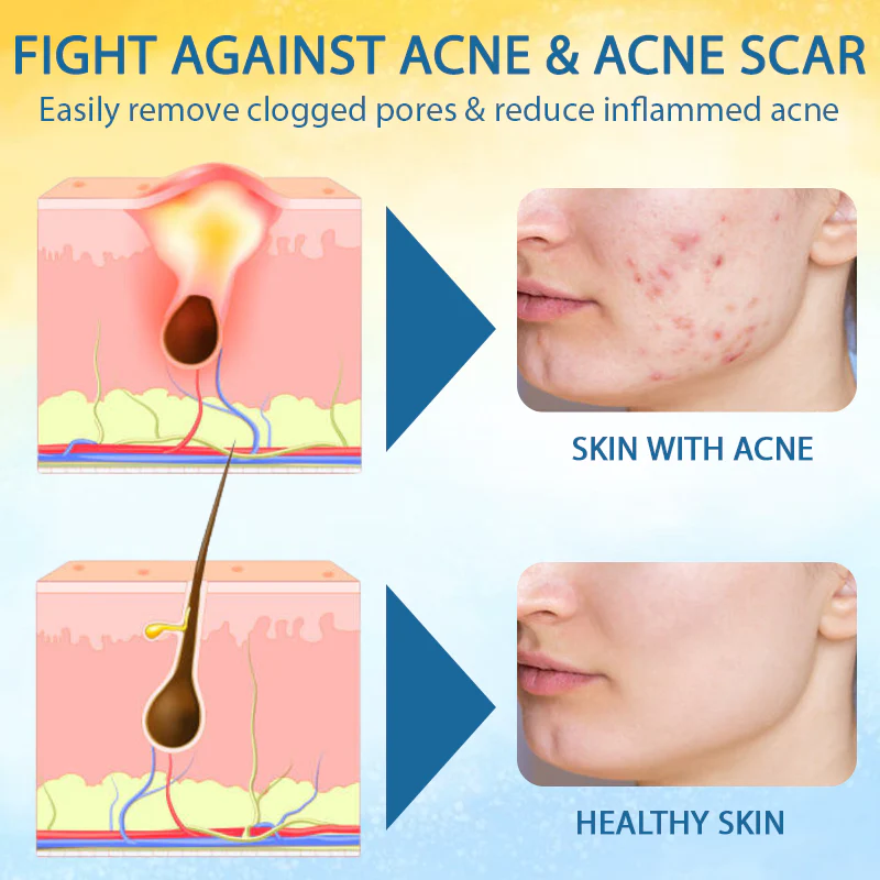 Croaie® PsoriasisCare Mellifera Venom Skin Healing Spray 7 Croaie® PsoriasisCare Mellifera Venom Skin Healing Spray