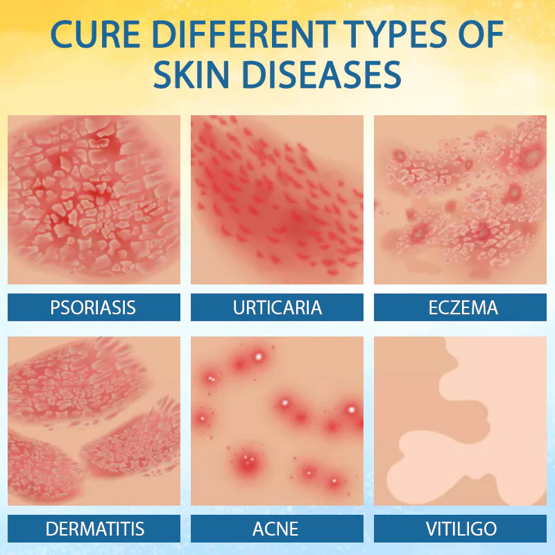 Croaie® PsoriasisCare Mellifera Venom Skin Healing Spray 5 Croaie® PsoriasisCare Mellifera Venom Skin Healing Spray