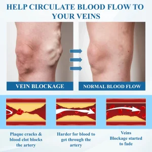 Cvreoz® VeinFocus Microneedle Leg Patch 25 Cvreoz® VeinFocus Microneedle Leg Patch