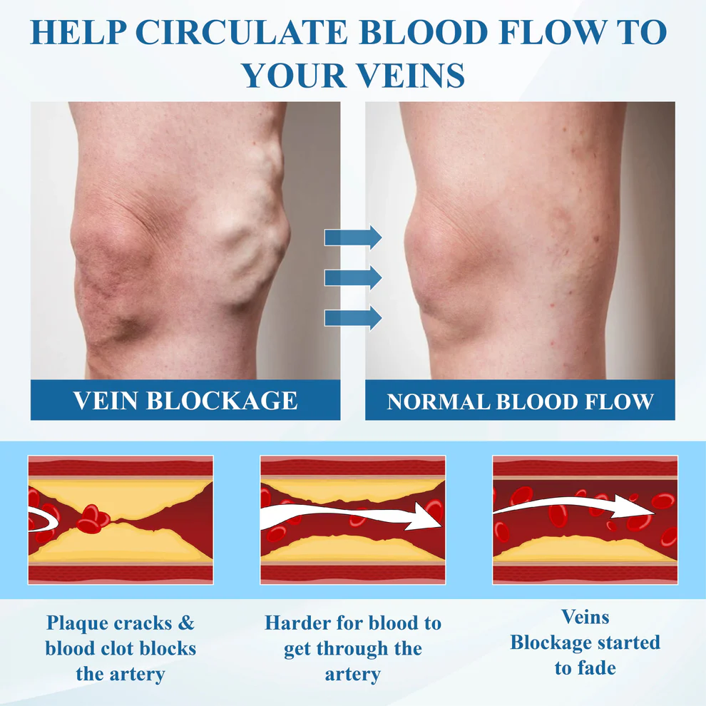 Cvreoz® VeinFocus Microneedle Leg Patch 13 Cvreoz® VeinFocus Microneedle Leg Patch