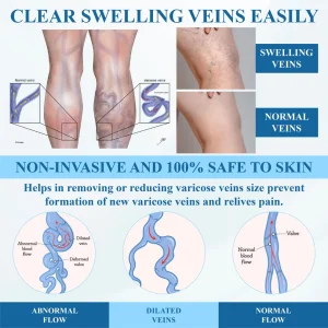 Cvreoz® VeinFocus Microneedle Leg Patch 23 Cvreoz® VeinFocus Microneedle Leg Patch