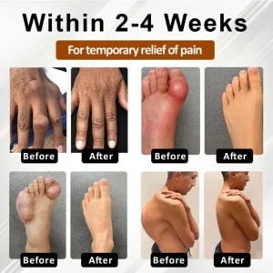 Bazenith™ MagniBee Joint Support Formula Spray 13 Bazenith™ MagniBee Joint Support Formula Spray