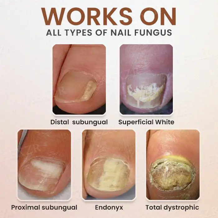 Piguiay® Nails Repairing Serum 3 Piguiay® Nails Repairing Serum