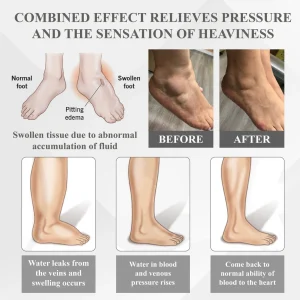 RICPIND® RedHeat EMS EdemaDrain Leg Massager 10 RICPIND® RedHeat EMS EdemaDrain Leg Massager