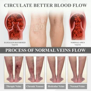 RICPIND® RedHeat EMS EdemaDrain Leg Massager 9 RICPIND® RedHeat EMS EdemaDrain Leg Massager