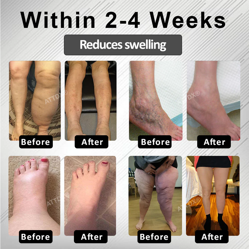 RICPIND® RedHeat EMS EdemaDrain Leg Massager 3 RICPIND® RedHeat EMS EdemaDrain Leg Massager