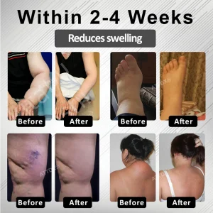 RICPIND® RedHeat EMS EdemaDrain Leg Massager 7 RICPIND® RedHeat EMS EdemaDrain Leg Massager