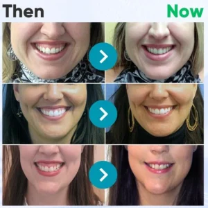 Dobshow® Bee Venom Dental Microgranules 10 Dobshow® Bee Venom Dental Microgranules