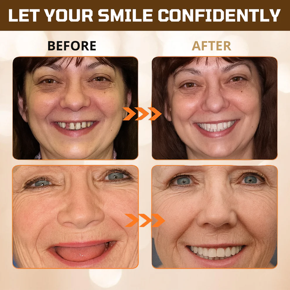 Cvreoz® Adsorptive denture 4 Cvreoz® Adsorptive denture