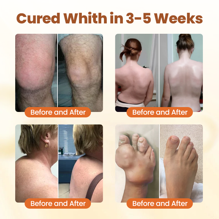 Caselast® Premium Curcumin Pain Relief Gel 4 Caselast® Premium Curcumin Pain Relief Gel