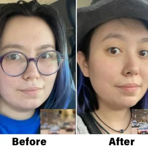 NESLEMY™ Nano Vision Repair Eye Serum 13 NESLEMY™ Nano Vision Repair Eye Serum