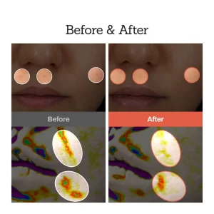 NESLEMY™Retinal Skin Booster Serum 13 NESLEMY™Retinal Skin Booster Serum