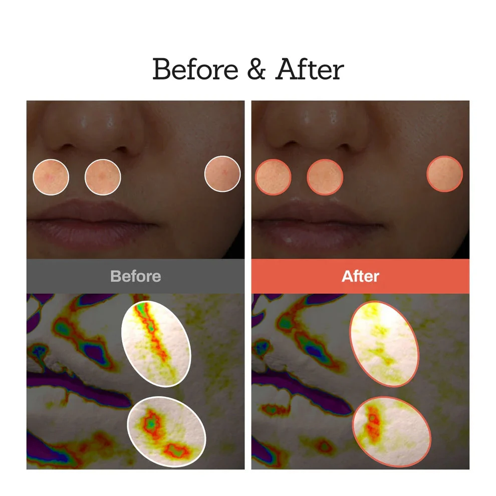 NESLEMY™Retinal Skin Booster Serum 3 NESLEMY™Retinal Skin Booster Serum