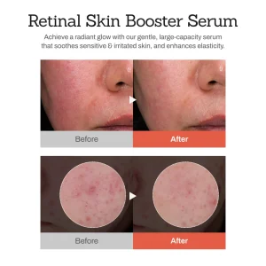 NESLEMY™Retinal Skin Booster Serum 12 NESLEMY™Retinal Skin Booster Serum