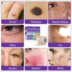 Flysmus® ReGen Hyaluronic Acid Nano-Heal Microneedle Tape 10 Flysmus® ReGen Hyaluronic Acid Nano-Heal Microneedle Tape