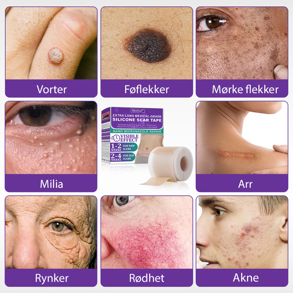 Flysmus® ReGen Hyaluronic Acid Nano-Heal Microneedle Tape 2 Flysmus® ReGen Hyaluronic Acid Nano-Heal Microneedle Tape