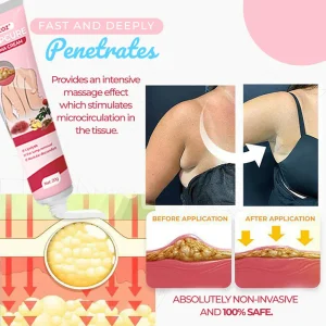 CVREOZ® LumpCure Lipoma Cream 10 CVREOZ® LumpCure Lipoma Cream