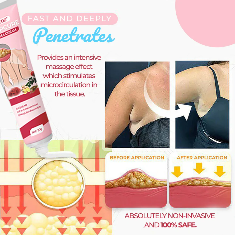 CVREOZ® LumpCure Lipoma Cream 3 CVREOZ® LumpCure Lipoma Cream