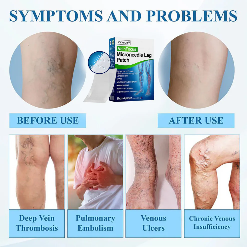 Cvreoz® VeinFocus Microneedle Leg Patch 5 Cvreoz® VeinFocus Microneedle Leg Patch