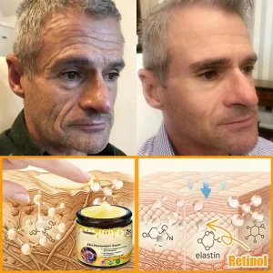 Laozik™ Skin Restoration Cream