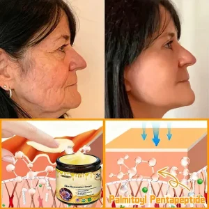 Laozik™ Skin Restoration Cream