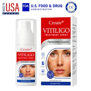 Croaie® Vitiligo Treatment Spray – No allergies