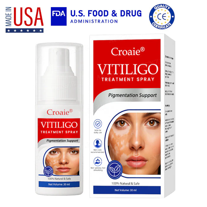 Croaie® Vitiligo Treatment Spray – No allergies 1 Croaie® Vitiligo Treatment Spray – No allergies